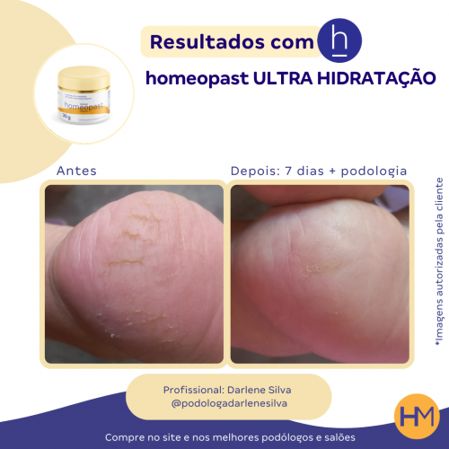 Ultra Hidratação